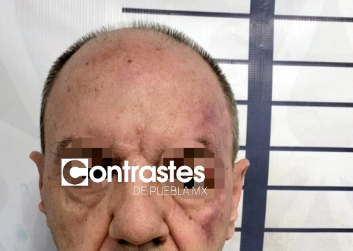 Detienen al tirador de la Vía Atlixcáyotl, es el empresario Rafael N (vídeo)