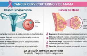 Puebla suma 288 muertes por cáncer de mama y 118 por cáncer cervicouterino en 2026
